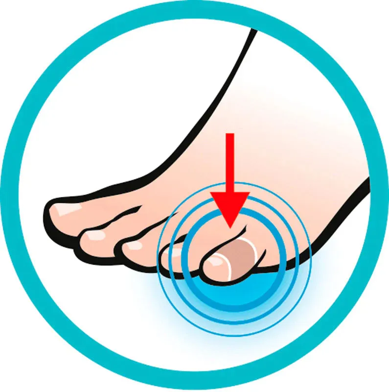 Toe Protectors